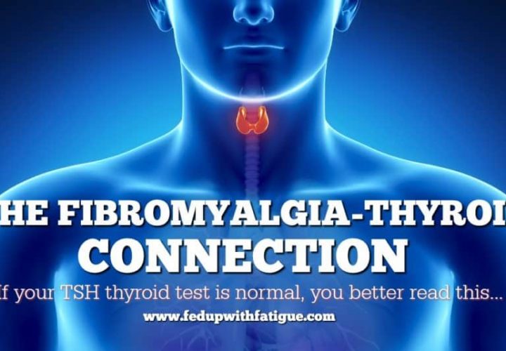 Is A Dysfunctional Thyroid Gland Responsible For Fibromyalgia?