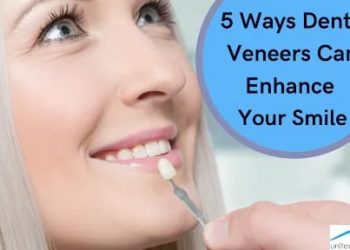 5 Ways Dental Veneers Can Enhance Your Smile