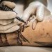 Laser Hair Removal