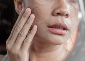 derma co alpha arbutin serum