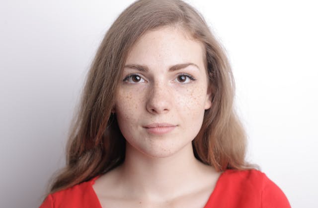 Dark spots