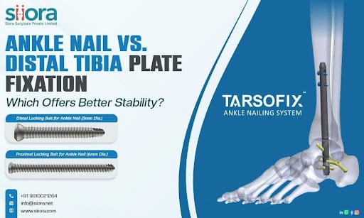 Ankle Nail vs. Distal Tibia Plate Fixation – Which Offers Better Stability?