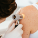Skin Cancer Clinic